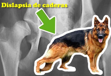 dislapsia de cadera